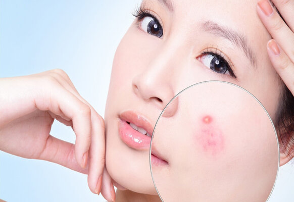Rượu táo mèo có tác dụng gì Rượu táo mèo có tác dụng gì