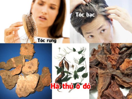 Hà thủ ô đỏ trị rụng tóc - 1 trong những tác dụng tuyệt vời