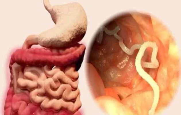 Tác dụng của hạt mắc khén chữa giun sán Hạt mắc khén và những tác dụng