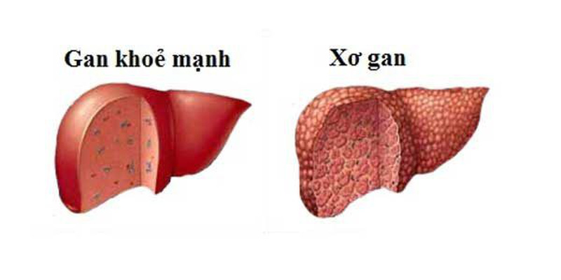 Uống nước cây cà gai leo có tác dụng gì