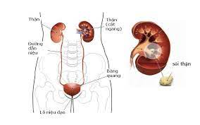 Tác dụng phụ của cây cà gai leo Tác dụng phụ của cây cà gai leo