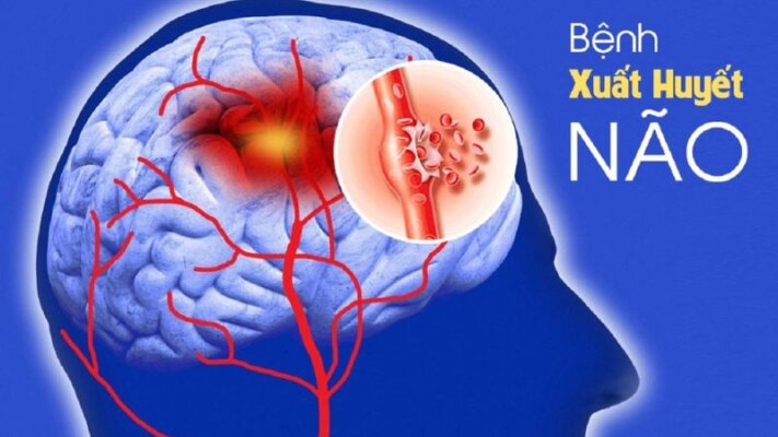 Công dụng của tam thất đen Công dụng của tam thất đen