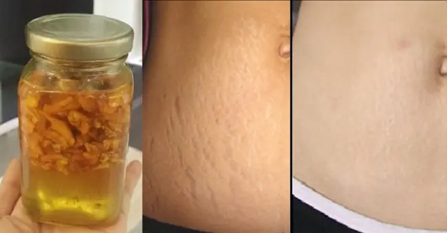 Nghệ đen ngâm rượu có tác dụng gì Nghệ đen ngâm rượu có tác dụng gì