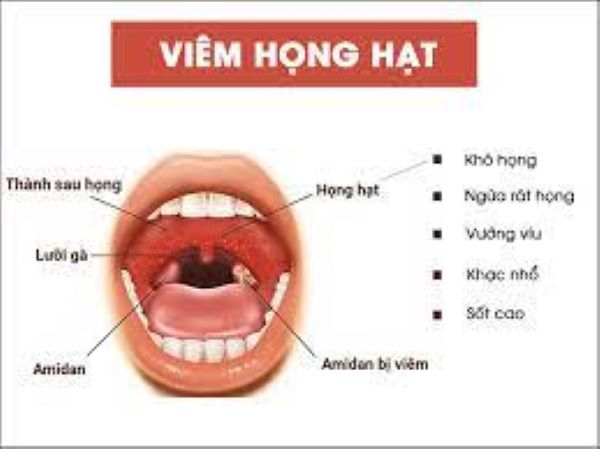 Uống nghệ đen mật ong khi nào