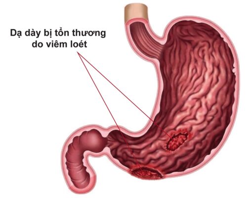 Công dụng của lá bạc hà trong chữa bệnh
