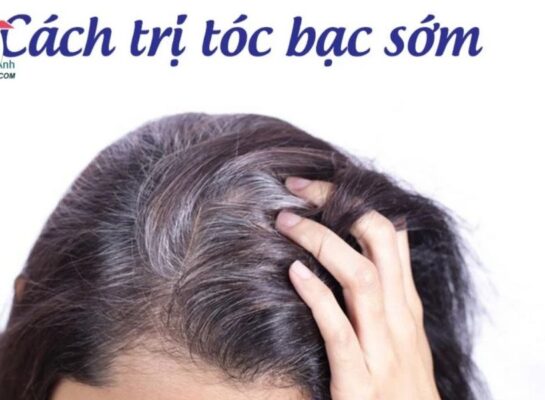 Cách chữa bạc tóc sớm tại nhà bằng Hà thủ ô