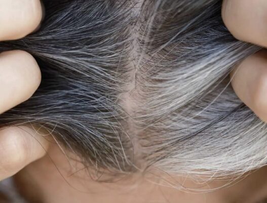 Đàn ông sử dụng hà thủ ô mật ong viên vừng chữa bạc tóc Đàn ông sử dụng hà thủ ô mật ong viên vừng chữa bạc tóc