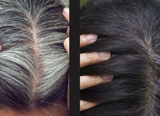 Cách chữa tóc bạc bằng Hà thủ ô đỏ Tây Bắc