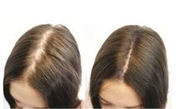 Cách sử dụng Hà thủ ô kích thích mọc tóc