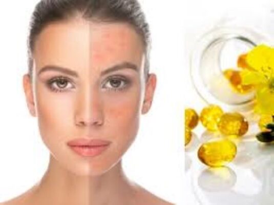 Lợi ích của dầu hoa Anh Thảo