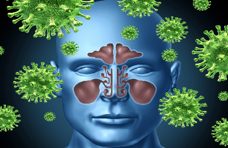 Triệu chứng của bệnh viêm xoang