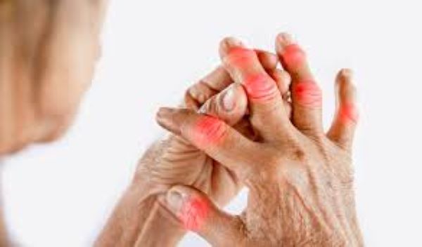 Tác dụng chưaz bệnh gout của củ bình vôi
