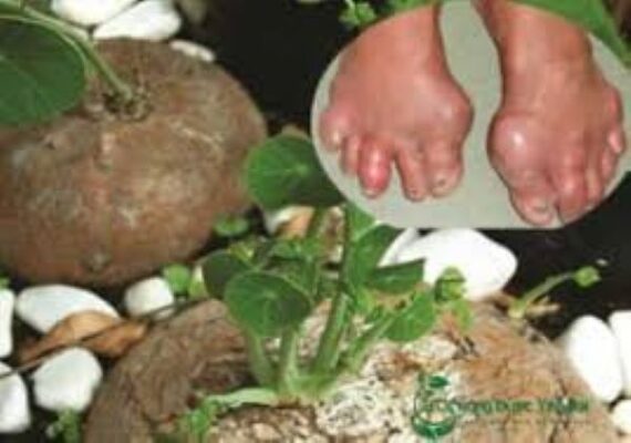 Cây bình vôi chữa gout như thế nào?