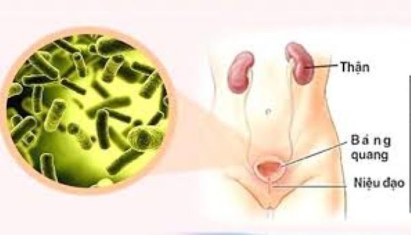 Cây Kim tiền thảo chữa bệnh gì?