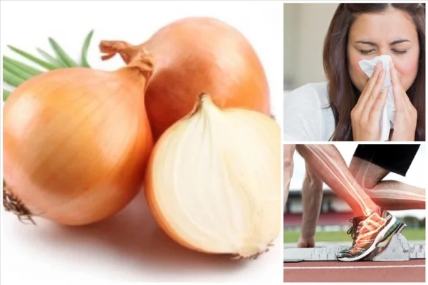 Công dụng chữa bệnh của củ hành tây