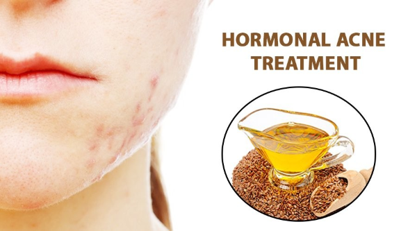 Công dụng của dầu hạt lanh