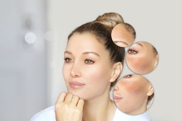 Tác dụng của dầu dừa với da