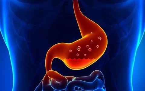 9 loại thảo dược làm giảm axit dạ dày