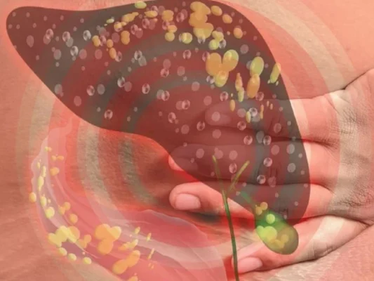 Hiểu đúng về gan nhiễm mỡ