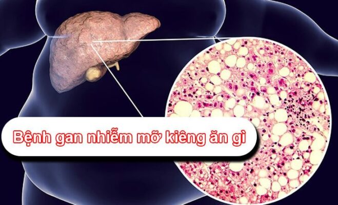 Bệnh gan nhiễm mỡ nên uống lá gì để cải thiện sức khỏe?